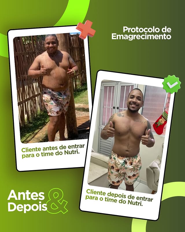 Antes e Depois - Resultado 3